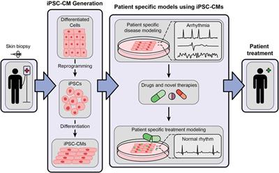 Human induced pluripotent stem cell-derived cardiomyocytes (iPSC-CMs) for modeling cardiac arrhythmias: strengths, challenges and potential solutions